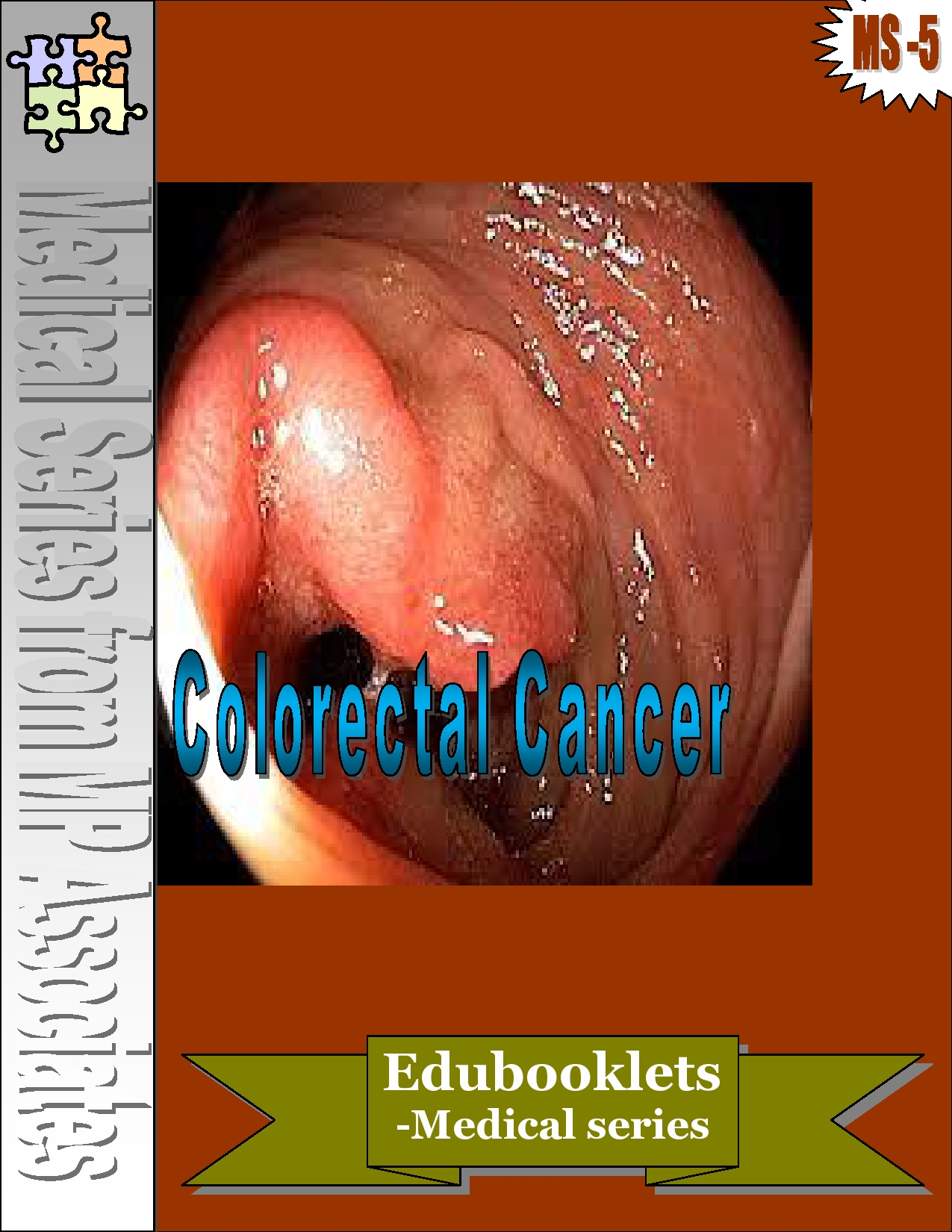 Colorectal Cancer Colorectal Cancer